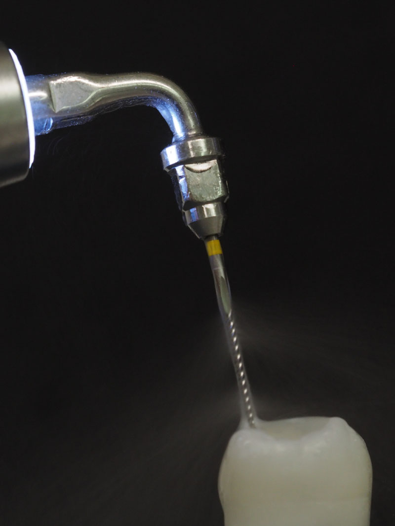 Ratgeber_Zaehne_Endodontie_Ultraschall Ratgeber_Zaehne_Endodontie_Ultraschall